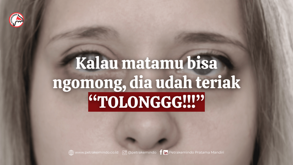 Kantung mata & mata panda