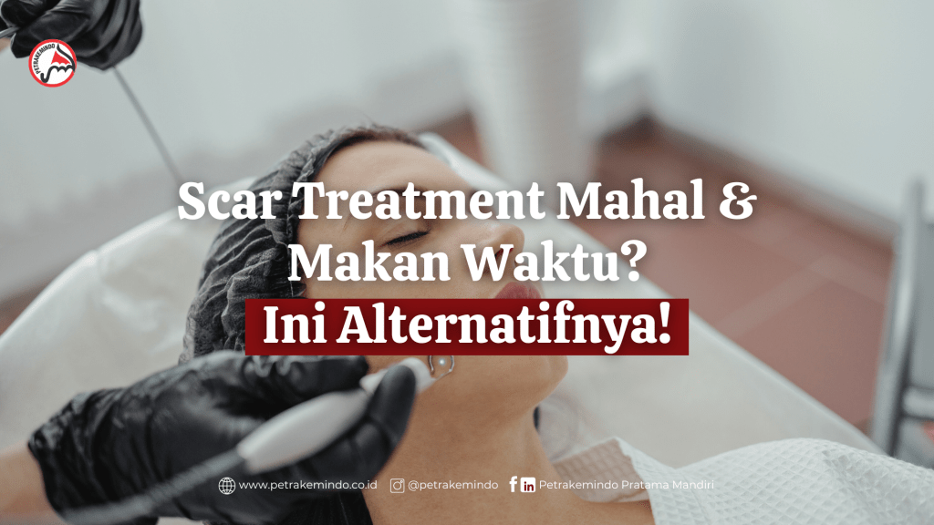 Laser treatment for acne scar