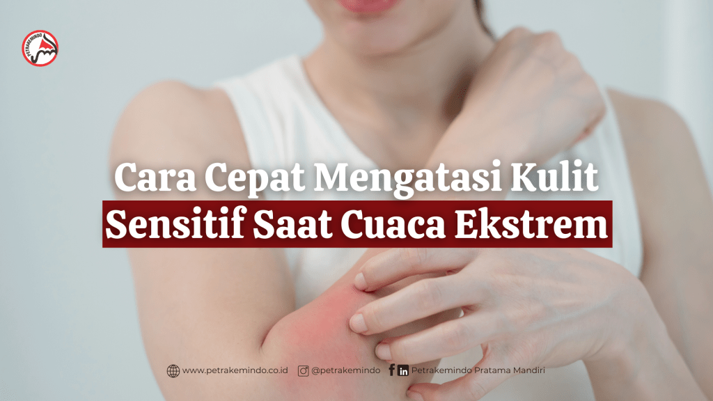 Cara Cepat Mengatasi Kulit Sensitif Saat Cuaca Ekstrem